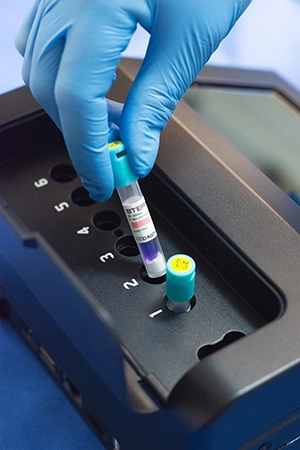 inkubacja testu biologicznego